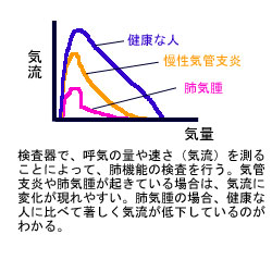 肺機能検査とフロボリューム曲線