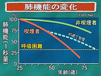 肺機能検査比較曲線グラフ