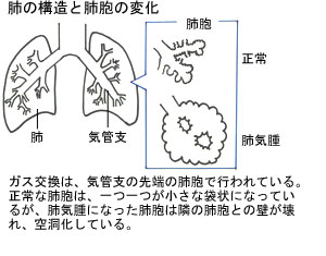 肺の構造と肺胞の変化